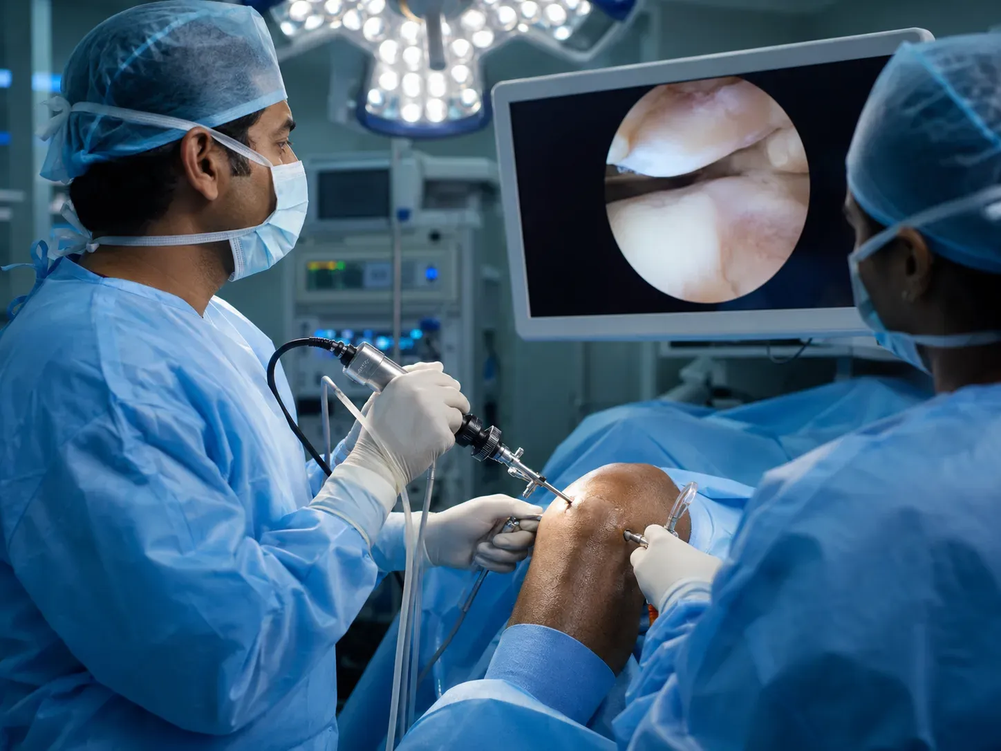Knee Arthroscopy Cost in India for Ghana Patients